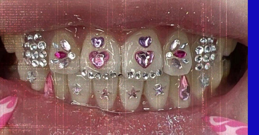 Tooth gem work at Afters Beauty